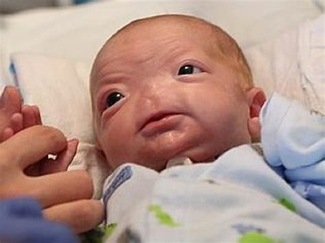Parents Of Newborn Baby Born Without A Nose Call Him Perfect