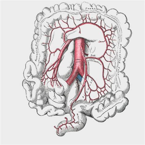 P4227 Inferior Mesenteric Artery And Branches Isolated Prosections