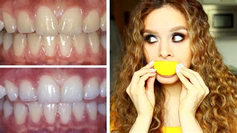 Beautiful white teeth it seems can also be the luck of the draw. DIY: How to whiten teeth naturally for CHEAP! - YouTube