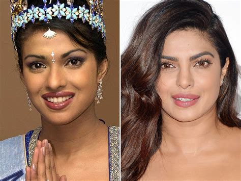 priyanka chopra before and after nose job celebrities before and after celebrity plastic