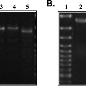 Ethidium Bromide Stained Agarose Gels Showing The Results Of Pcr