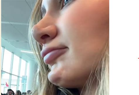 This Woman Left Distraught After Spotting A Dent In Her Chin Following A Cosmetic Procedure How