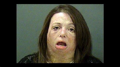 These 21 Before And After Photos Of Meth Addicts Will Stop You In Your