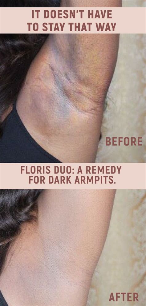 Say Goodbye To A Dark Armpits With Floris Duo Dark Armpits Better