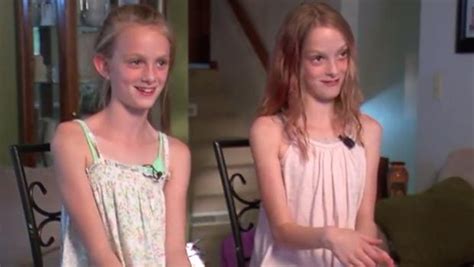 Learn how they have defied the odds and continue to inspire the world. North Dakota conjoined twins celebrate 10 years apart - CBS News