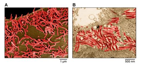 Filoviridae A Scanning Electron Micrograph Of Marburg Virus Particles
