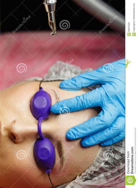 Trimming, shaving or waxing eyebrows is prohibited for at least 3 days in order for the skin on that area to remain strong before receiving the treatment. Laser Removal Of Tattoo Eyebrows Stock Photo - Image of ...