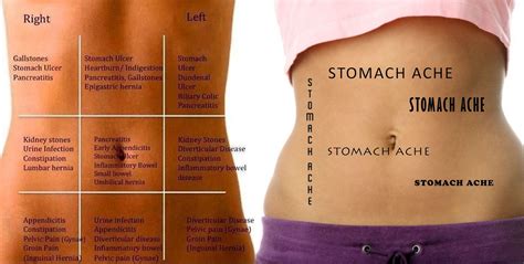 Stomach Pain Chart to Understand What Your Pain Tells You