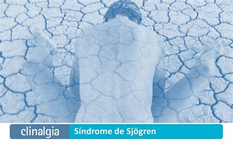 Síndrome De Sjögren Síntomas Y Tratamiento Síntomas Y Tratamiento