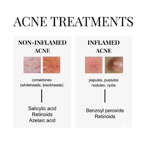 Acne Treatments Acne Treatment Types Of Acne Skin Tips
