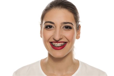 Adult Orthodontics Why It Is Never Too Late For Braces