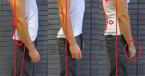 Corrective Exercise To Improve Your Posture Slouching Kyphosis