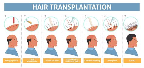 Hair Transplant Treatment Booking Surgery