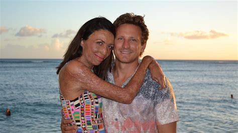 What Turia Pitts Fiance Michael Hoskin Thought As She Lay In Hospital Nt News