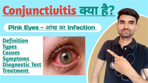 Conjunctivitis In Hindi Causes Symptoms And Treatment Of