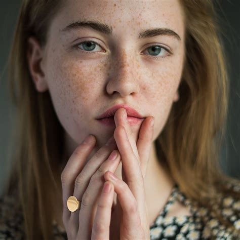 Essential Things One Must Know About Freckles And Moles