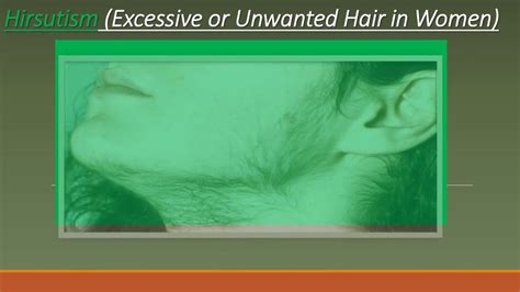 Excessive Or Unwanted Hair In Women Hirsutism Doctor S Tips Hirsutism Unwanted Hair Unwanted
