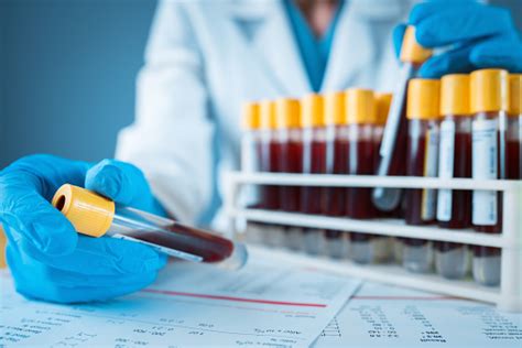 Laboratory Result With Blood Tubes Stock Photo Download Image Now