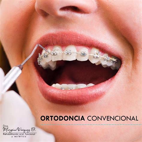 Ortodoncia Clinica Dental Mldent
