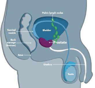 Symptoms of prostate cancer can include: What is prostate cancer? — Prostap DCS