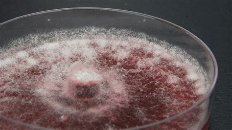 Deadly Fungal Meningitis Outbreak Linked To Cosmetic Procedures In