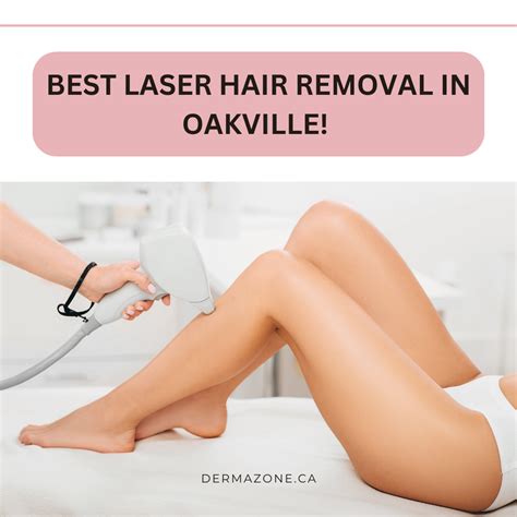 Get The Best Laser Hair Removal Treatment In Oakville Dermazone Medium