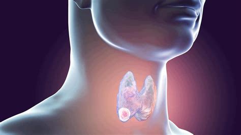 Thyroid Biopsies Everything You Need To Know Step To Health
