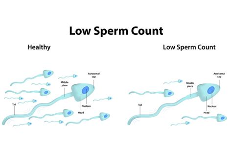 How To Increase Your Sperm Count Naturally Jiva Ayurveda