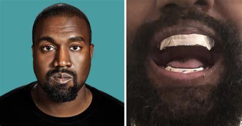 Kanye West Gives His Teeth A Titanium Makeover That Reportedly Costs