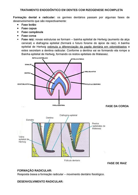 TRATAMENTO ENDODÔNTICO EM DENTES COM RIZOGENESE INCOMPLETA TRATAMENTO ENDODÔNTICO EM DENTES