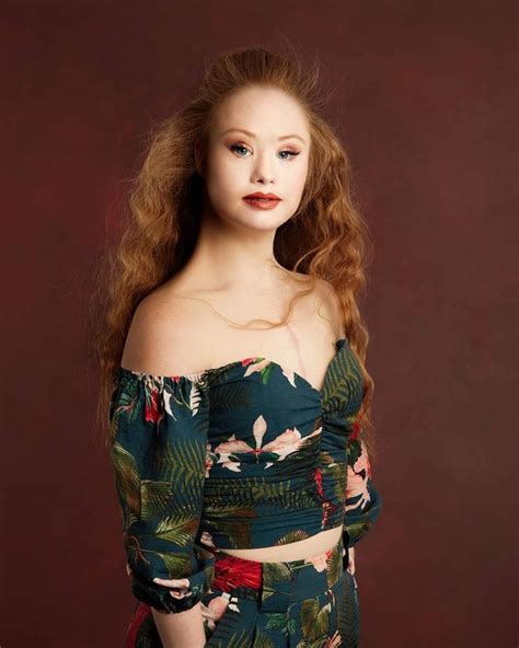 model with down syndrome who walked in “new york paris and london fashion weeks” is an