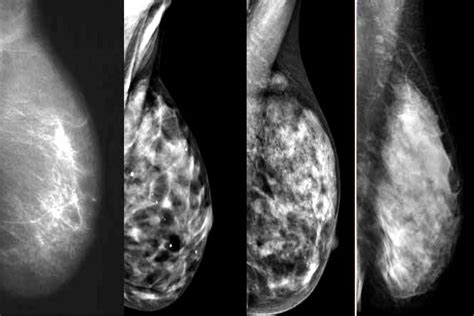 Simple Science: How to Make a Volcano with Kids