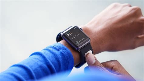 25 крутых фич в apple watch + скрытые функции. Apple Watch Gets First EKG Reader in AliveCor KardiaBand ...