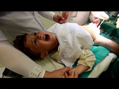 Que Es Una Circuncisión En Los Niños Noticias Niños
