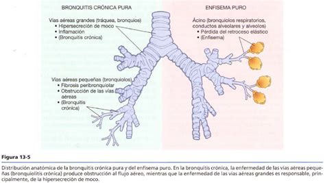 Agustina Ocampo Patología B 2014 Epoc Enfisema Y Bronquitis Crónica