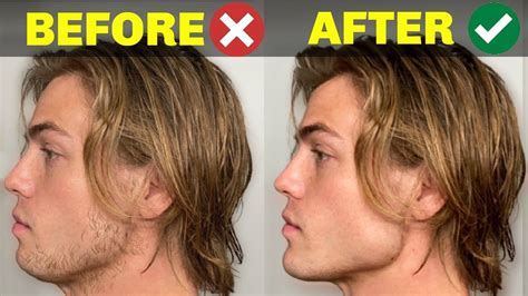 5 Things You Do That Are Ruining Your Jawline Chiseled Jaw Jawline