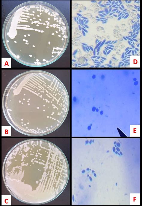 Yeast Cultures Growing On Ypda A Fission Yeast B Budding Yeast C