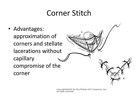 Ppt Suturing Basics Powerpoint Presentation Free Download Id2156670