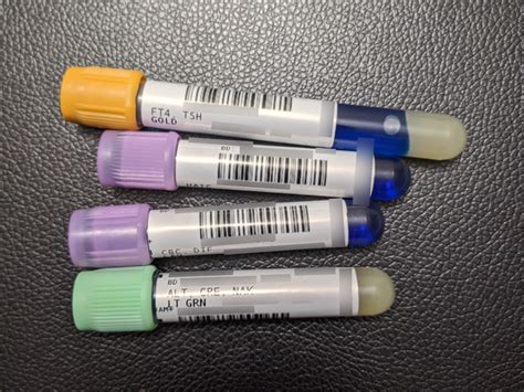 How To Label A Blood Sample 9 Steps With Pictures Wikihow