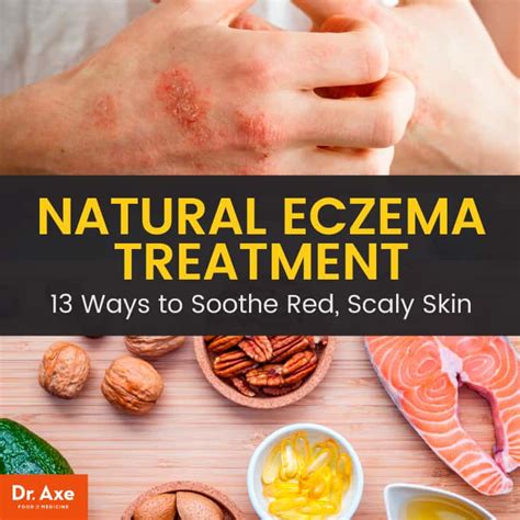 13 Best Natural Eczema Treatment Options Dr Axe