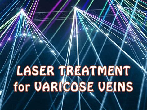 Laser Treatment For Varicose Veins Remove Them Denver Vein Center