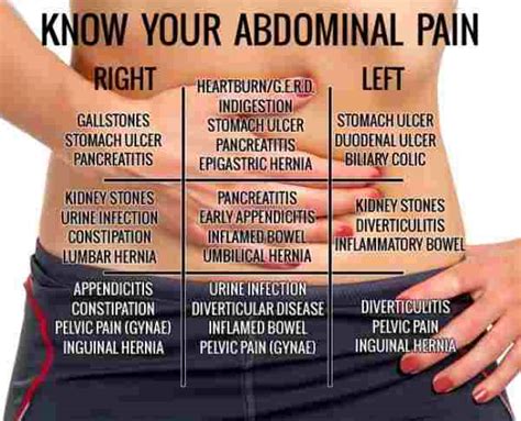 Bloating Abdominal Pain Lower Back Pain Abdominal Lower ...