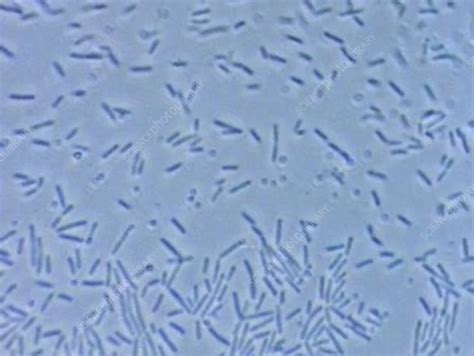 Clostridium, enterococcus, salmonella and good bacteria: E Coli Bacteria Under Light Microscope - Micropedia