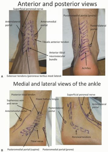 Ankle Arthroscopy—basics Musculoskeletal Key