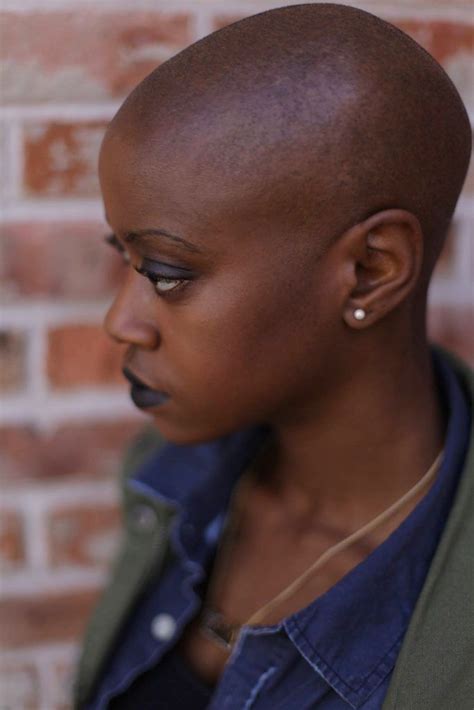 My Struggle With Alopecia How I Learned To Find The Beauty In My