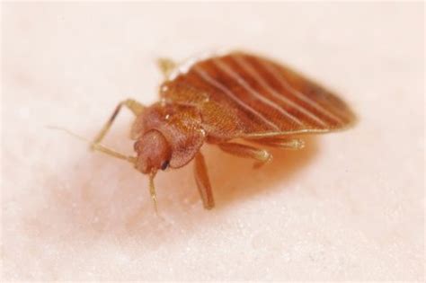 The First Minister Needs To Sort The Govan Bed Bug Plague School Out