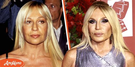 Experts Believe Donatella Versace Had Several Plastic Surgeries And She