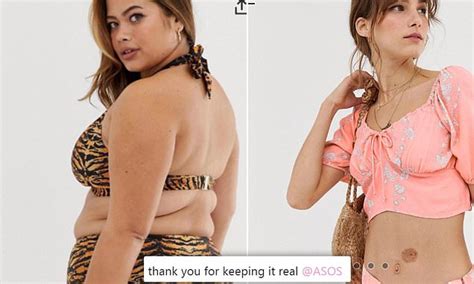 Woman Praises Asos For Keeping It Real By Not Retouching ‘imperfections On Models Daily