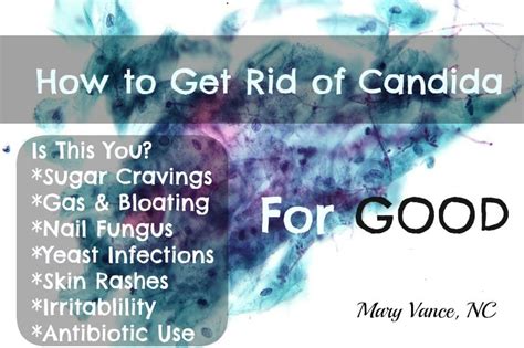 How To Get Rid Of Candida Overgrowth—for Good Mary Vance Nc