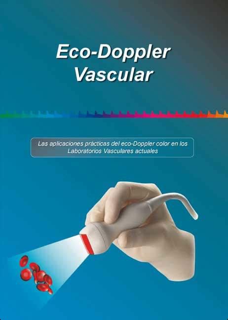 Eco Doppler Vascular Las Aplicaciones Pr Cticas Del Eco Doppler Color En Los Laboratorios Vasculars